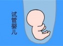 培养济南捐卵宝宝艺术细胞的小技巧